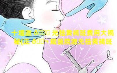 十堰激 🍁 光祛黄褐斑费用大揭秘(正 🐬 规医院激光祛黄褐斑多少钱)